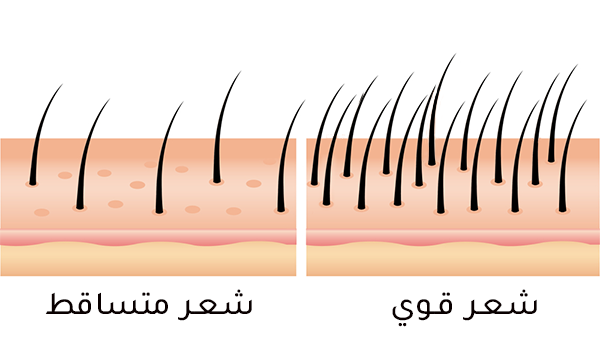 Rehab Bio Cosmetics - Huile anti-chute - Problème